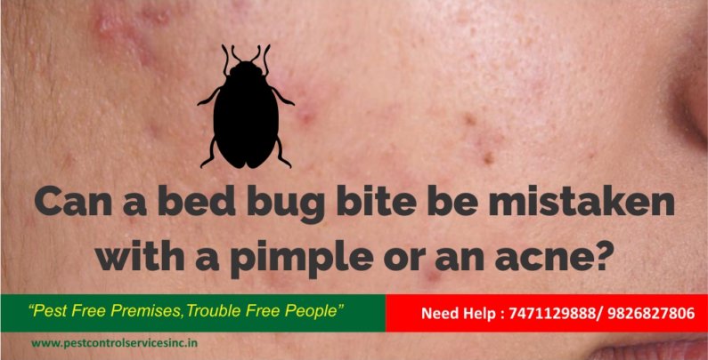 Can a bed bug bite be mistaken with a pimple or an acne-